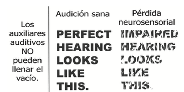 Dos columnas con la misma frase: en audición sana se lee nítida; con pérdida neurosensorial las letras están comidas y cuesta reconocerlas