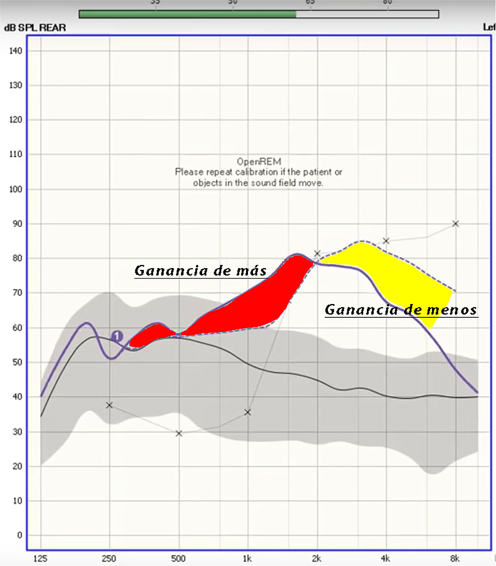 Gráfica antes de la corrección: zonas de exceso y de falta de ganancia